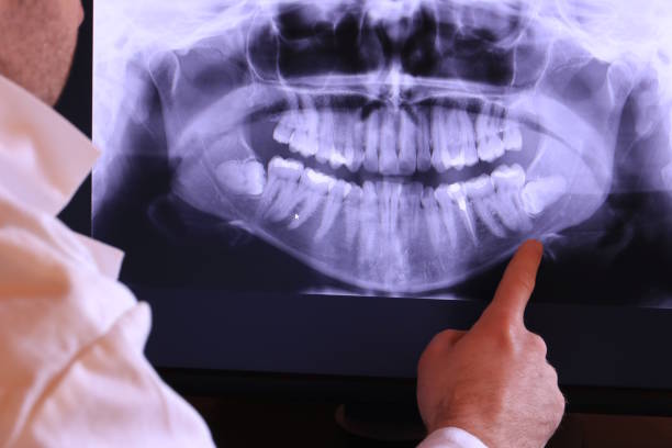 Best Emergency Root Canal Treatment in Carney, MD
